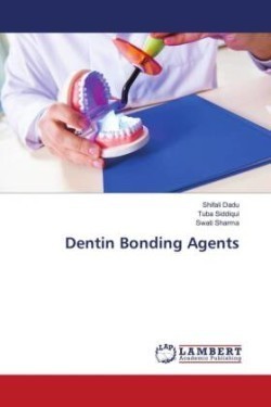 Dentin Bonding Agents