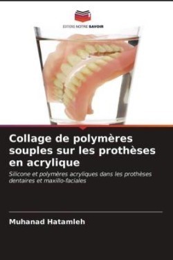 Collage de polymères souples sur les prothèses en acrylique