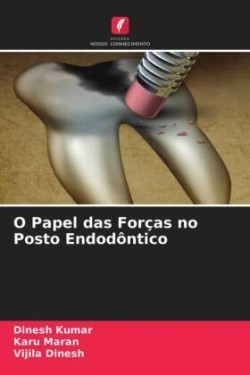 O Papel das Forças no Posto Endodôntico