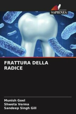 Frattura Della Radice