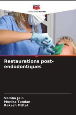 Restaurations post-endodontiques