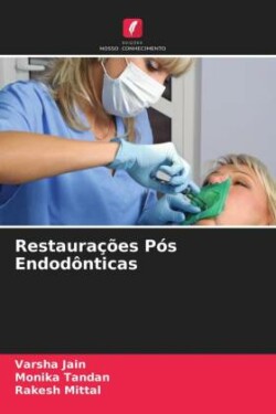 Restaurações Pós Endodônticas