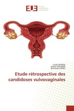 Etude rétrospective des candidoses vulvovaginales