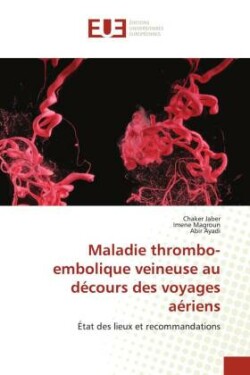 Maladie thrombo-embolique veineuse au décours des voyages aériens