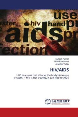 Hiv/AIDS