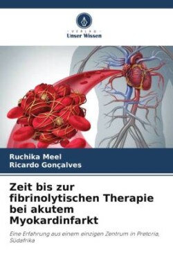 Zeit bis zur fibrinolytischen Therapie bei akutem Myokardinfarkt