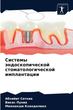 Системы эндоскопической стоматологичес&#