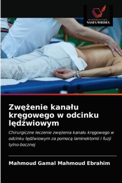 Zwężenie kanalu kręgowego w odcinku lędźwiowym