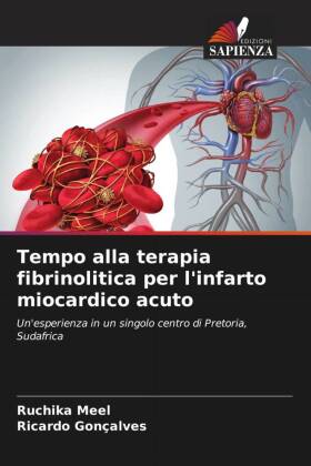 Tempo alla terapia fibrinolitica per l'infarto miocardico acuto