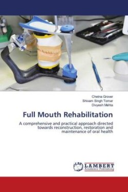 Full Mouth Rehabilitation