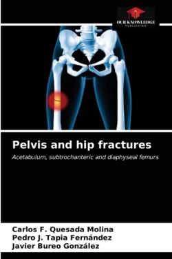 Pelvis and hip fractures