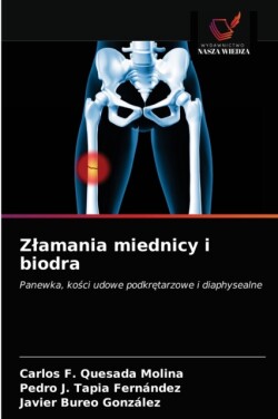 Zlamania miednicy i biodra