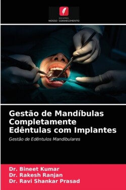 Gestão de Mandíbulas Completamente Edêntulas com Implantes