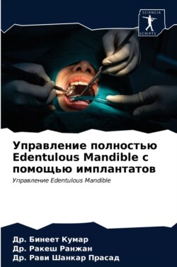 Управление полностью Edentulous Mandible с помощью имплан&
