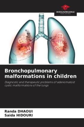 Bronchopulmonary malformations in children