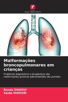 Malformações broncopulmonares em crianças