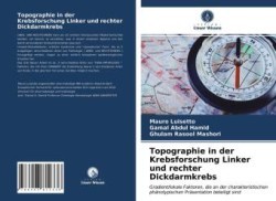 Topographie in der Krebsforschung Linker und rechter Dickdarmkrebs