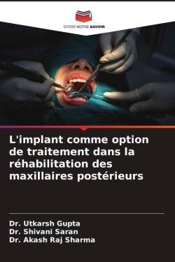 L'implant comme option de traitement dans la réhabilitation des maxillaires postérieurs