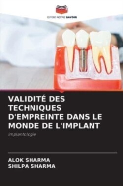 Validité Des Techniques d'Empreinte Dans Le Monde de l'Implant