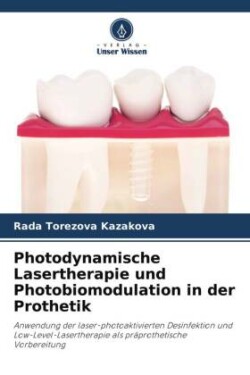 Photodynamische Lasertherapie und Photobiomodulation in der Prothetik
