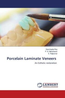 Porcelain Laminate Veneers