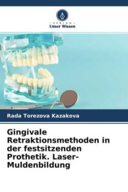 Gingivale Retraktionsmethoden in der festsitzenden Prothetik. Laser-Muldenbildung