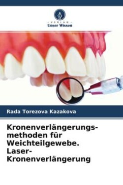 Kronenverlängerungs- methoden für Weichteilgewebe. Laser-Kronenverlängerung