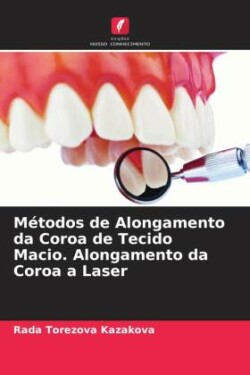 Métodos de Alongamento da Coroa de Tecido Macio. Alongamento da Coroa a Laser