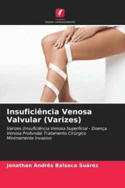 Insuficiência Venosa Valvular (Varizes)