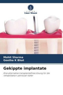 Gekippte implantate