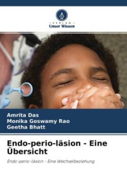 Endo-perio-läsion - Eine Übersicht