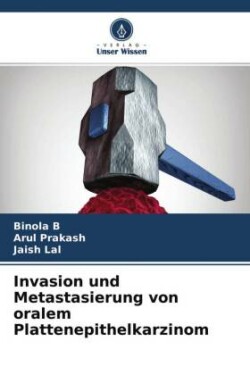 Invasion und Metastasierung von oralem Plattenepithelkarzinom