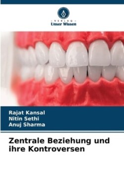 Zentrale Beziehung und ihre Kontroversen