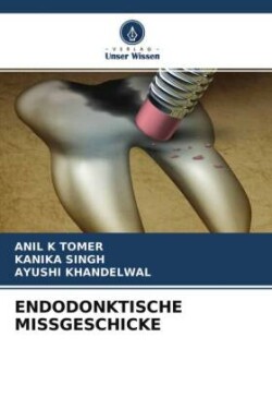 ENDODONKTISCHE MISSGESCHICKE