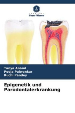 Epigenetik und Parodontalerkrankung