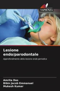 Lesione endo/parodontale