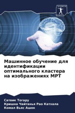 Mashinnoe obuchenie dlq identifikacii optimal'nogo klastera na izobrazheniqh MRT