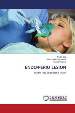 ENDO/PERIO LESION