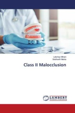 Class II Malocclusion