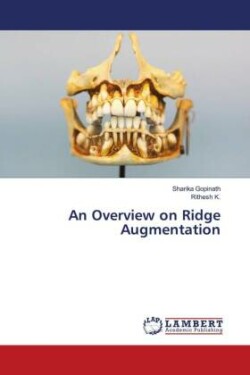 An Overview on Ridge Augmentation