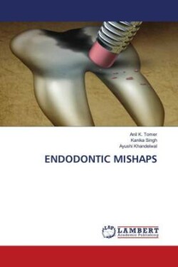 ENDODONTIC MISHAPS