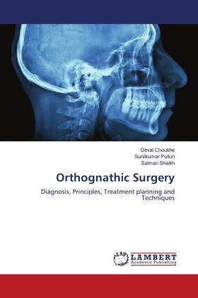 Orthognathic Surgery