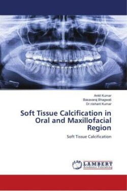 Soft Tissue Calcification in Oral and Maxillofacial Region