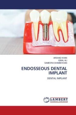 ENDOSSEOUS DENTAL IMPLANT