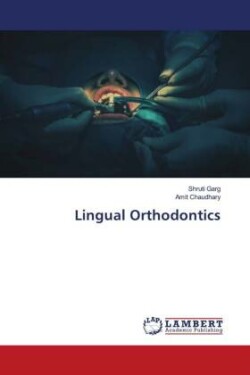 Lingual Orthodontics