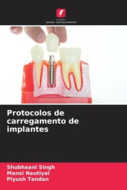 Protocolos de carregamento de implantes