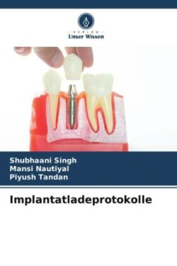 Implantatladeprotokolle