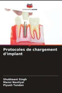 Protocoles de chargement d'implant