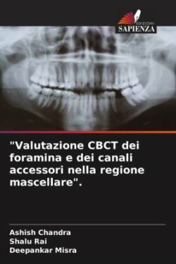 "Valutazione CBCT dei foramina e dei canali accessori nella regione mascellare".