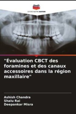 "Évaluation CBCT des foramines et des canaux accessoires dans la région maxillaire"